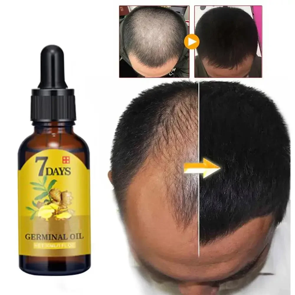Beard Oil Growth - Wzrost włosów Imbir Szybko rosnące włosy