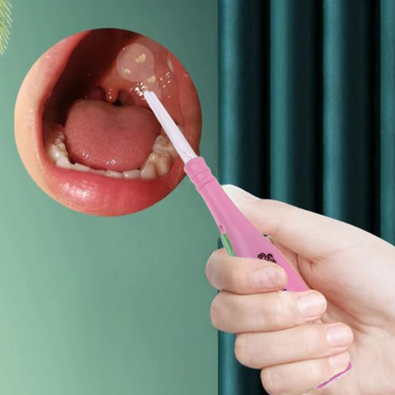 Narzędzia do usuwania kamieni  – Ear Wax Remover recenzja i cena